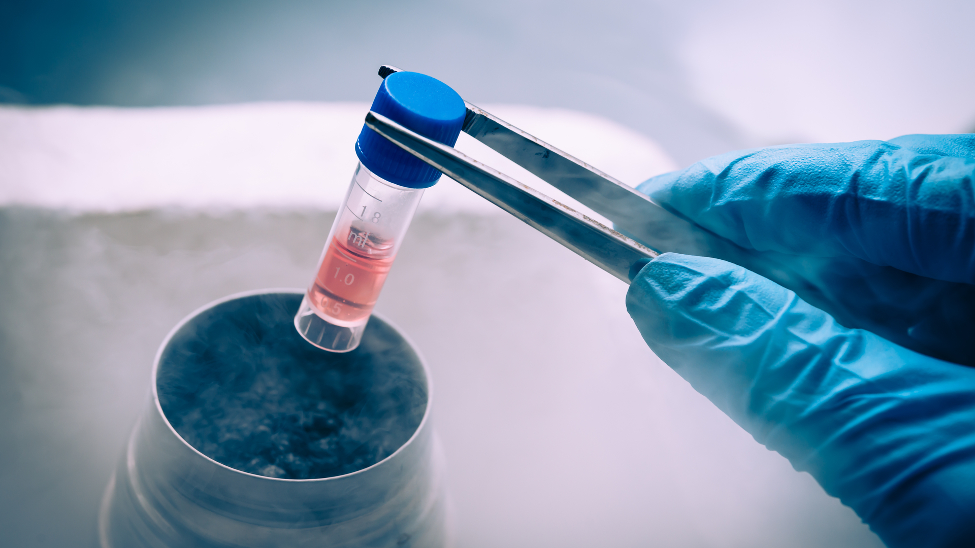El trasplante de células madre: un tratamiento innovador para diversas  enfermedades - Hematologia UANL